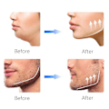 Miniatyrbild 5 av 5: Käktränare Jawline exerciser 2-pack Svart