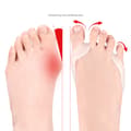Miniatyrbild 4 av 4: Tåsträckare, Bunion Corrector för stortån