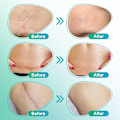 Pikkukuva 3 / 7: Arpiteippi - Silikoniarpiarkit Beige 1 m