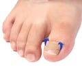 Miniatyrbild 3 av 3: 100 st tånagelkorrigeringssplåster Limfri pedikyrverktyg Corrector Toe Nail Inrown Patch