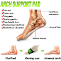 Miniatyrbilde 3 av 5: Buesupportpute, 4 par ortopediske innleggssåler med buesupport kompresjonsputer for plantar fasciitt