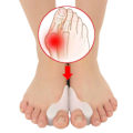 Pikkukuva 2 / 4: Hallux Vulgus -suojaus - TOE -levitin 2 kpl suuret valkoinen