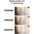 Miniatyrbillede 4 af 5: IPL Laser Epilator, Epilator til ansigt, armhuler, krop og bikini.