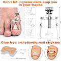 Miniatyrbild 2 av 6: Innate Nagelsats, Innate Nagelklippare, Innate Naglar, 11 stycken Innate Nagelkorrigerare, Innate Nagelsats, Innate Nagelklippning