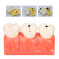Miniatyrbild 1 av 8: Högt Simulerad Dental Undervisningshjälp, Syntetisk Hartstandmodell För Professionell Träning Och Utbildning, Tydlig Morfologisk Struktur, Vuxen