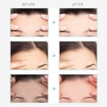 Miniatyrbilde 3 av 5: Facial Patches, Anti Wrinkle Patch, Anti Wrinkle Forehead, Anti Wrinkle Patches for Face, Anti Wrinkle Face Patch, Anti Wrinkle Forehead Patch, 20 Pcs