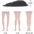 Miniatyrbillede 3 af 6: 3 Par (Sorte) Supination & Over-Pronation Korrigerende Skoindsatser, ZQKLA