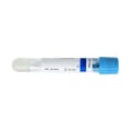 Miniatyrbillede 3 af 5: 2x 10ml Syre Gel Bund Negativt Tryk Plast Rør Trombocyt Plasmaindsamling Og Måling T