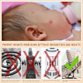 Miniatyrbillede 4 af 5: (Hvid Daisy) Myggenet til barnevogn, Baby Pram Net Bærbar Daisy Print Barnevognsnet Dækning Per