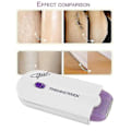 Miniatyrbillede 2 af 5: Finishing Touch Hårfjerner Smerteløs Epilator Med Mro Vibration