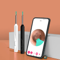 Miniatyrbillede 4 af 8: 8 ST 1080P Trådløst Øreendoskop Ørerensningsværktøj White 8 PCS Set