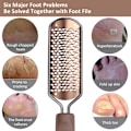 Miniatyrbillede 3 af 8: Fodfil til Pedicure - Callusfjerner - Stor Fodrasp - Kolossal Fod