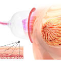 Miniatyrbillede 4 af 5: Brystmassageinstrument til at forstørre bryster - Lazy People Wave Cup Bre