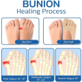 Pikkukuva 6 / 10: 2Pari Five Finger Socks Naisten halkaistut varvassukat BEIGE B B Beige B-B