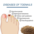 Miniatyrbilde 4 av 10: 2 esker Nail Repair Patches Anti Fungal Negle Patches Fungal