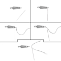 Pikkukuva 3 / 4: Neulalangat Neulalankatyökalut Ompeluneulalanka
