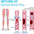 Pikkukuva 4 / 10: Polvikorkeat reisisukat Ionic Lymphatic Detoxification -sukat MUSTA Black