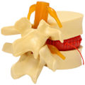 Miniatyrbillede 1 af 5: Lumbal Hvirvel Model Anatomisk Rygsøjle Lumbal Diskusprolaps Anatomi Undervisningsværktøj Lumbal Hvirvel
