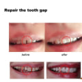 Miniatyrbilde 3 av 4: 3 stk. Solid Tooth Gel Vampire Fangs Kit Tilpassede Fangs Falske Gebisser  Tenner Pellets Lim for Cosplay Festrekvisita