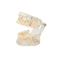 Miniatyrbillede 7 af 10: Anatomisk Tandmodell - Tandprotes White