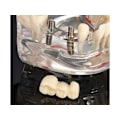 Miniatyrbillede 6 af 10: Anatomisk Tandmodell - Tandprotes Blue