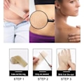 Miniatyrbillede 4 af 4: Silikonetape / Plaster til Ar – Behandling af ar