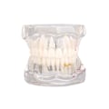 Miniatyrbillede 6 af 10: Anatomisk Tandmodell - Tandprotes White
