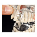 Miniatyrbild 4 av 10: Anatomisk Tandmodell - Tandprotes Blå