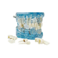 Miniatyrbillede 10 af 10: Anatomisk Tandmodell - Tandprotes Blue