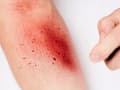 Pikkukuva 9 / 10: Halloween blodspray avtagbar make-up 60ml