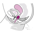 Miniatyrbillede 4 af 5: Fun Factory - Smartball Uno Pelvic Ball Hvid / Pastel Lilac