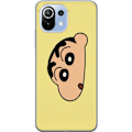 Pikkukuva 1 / 3: Xiaomi 11 Lite 5G NE Läpinäkyvä kuori Peeking Shinchan