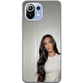Pikkukuva 1 / 3: Xiaomi 11 Lite 5G NE Läpinäkyvä kuori Kim Kardashian – Iconic Style Collection