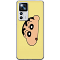 Pikkukuva 1 / 3: Xiaomi 12T Läpinäkyvä kuori Peeking Shinchan