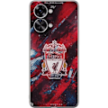 Pikkukuva 1 / 3: OnePlus Nord 2T Läpinäkyvä kuori Liverpool