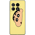 Pikkukuva 1 / 3: OnePlus 10 Pro Läpinäkyvä kuori Peeking Shinchan