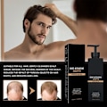 Miniatyrbillede 4 af 5: TG Root Activator Shampoo, Håravfaldsshampoo, Shampoo Root Activator