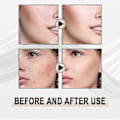 Miniatyrbild 5 av 5: Jaysuing Lactobionic Acid Liquid Gentle Exfoliating, Blackheads, Deep Clean -4100715360034