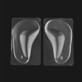 Pikkukuva 3 / 5: 4 par Gel Arch Support innersulor, silikon Ortopediska Platta fötter Orthotic Arch Support (transparent)