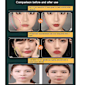 Miniatyrbild 4 av 5: Skönhetsskulpterande sovmask, återanvändbar V-linjeformande mask, V-linjelyftande mask ansiktsslankande rem - Dubbelhakreducerare - XinHan 2Pcs