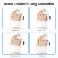 Miniatyrbild 5 av 5: 1* Hallux Valgus Korrigerare, Hallux Valgus Tåseparator - Vit
