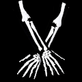Miniatyrbild 4 av 5: 2 par skeletthandskar Dödskallehandskar Lång arm Hel fingerhandskar