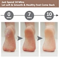Miniatyrbillede 5 af 5: Pedicure Foot File Callus Remover - stor fodrasp Kolossal fodskrubber Professionel rustfrit stål callusfil til våde og tørre fødder
