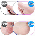 Miniatyrbillede 3 af 4: Super Grov Mikromineral Udskiftningsruller Kompatible med Em Micro Pedi Callus Remover (1 stk, Grå)