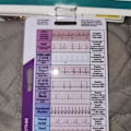 Miniatyrbilde 3 av 3: EKG/EKG Rytme Lommekort, Dobbeltsidig EKG Hjerte Badge Kort Lab Value