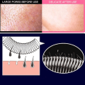 Miniatyrbillede 5 af 5: Ial Epilator Øjenbryns Epilator Ansigtshår Fjerner Fjeder Ansigt Epilator Rustfrit Stål Fjeder Epilator Værktøj Hår Fjernelse Enhedblue3pcs)