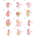 Miniatyrbillede 2 af 5: Rosa strygepatch bogstaver 26 stykker A-Z bogstav patch dyr sha