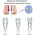 Miniatyrbild 3 av 5: Supination-inläggssulor för översupination och högt valvstöd, ortotiska in Size  39-40
