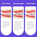 Miniatyrbild 4 av 4: 3 st/set Dental Tand Ortodontisk Apparat Tränare Tandställning Tänder Tränare För Vuxna Ortodontisk Tandställning {xpreenofficialstore}