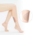 Miniatyrbillede 4 af 5: 10 Stk. Indvendig Lår Anti-slid Patch Tape Anti-gnidnings Body Lår Tape Hudvenlig